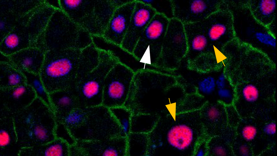 breakdown of liver cells age